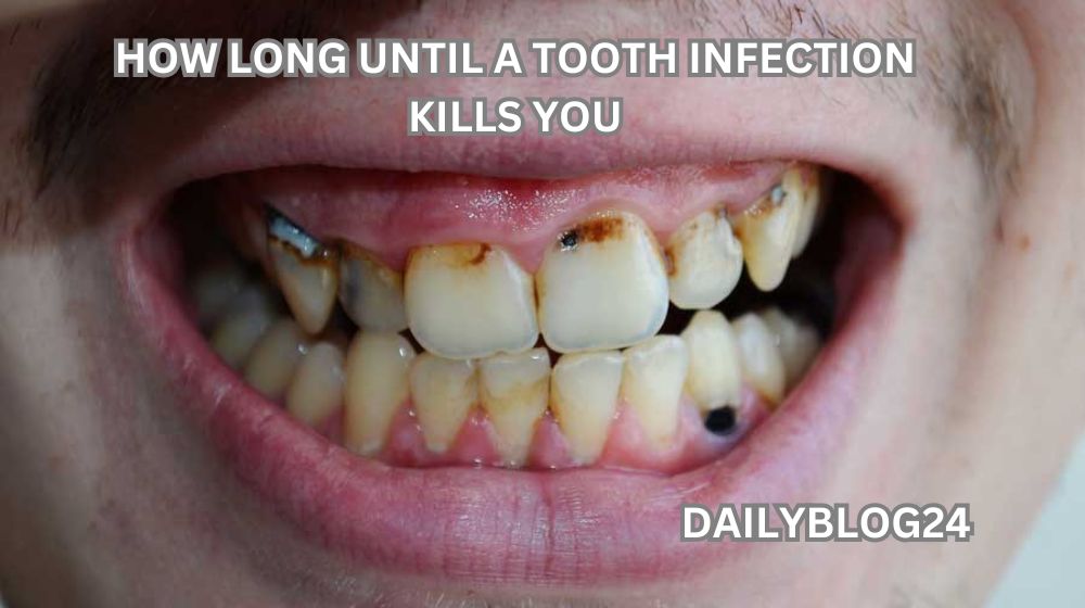 how long until a tooth infection kills you